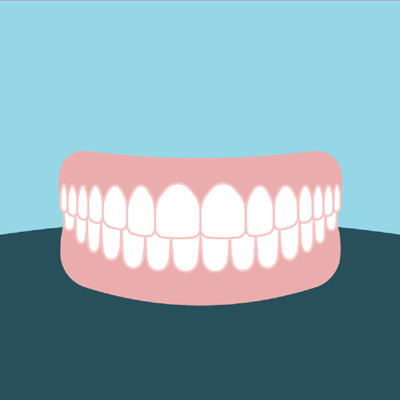 Dentures illustration