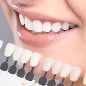 Teeth whitening chart next to teeth