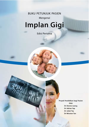 tn-A-Patients-Guide-to-Dental-Implants