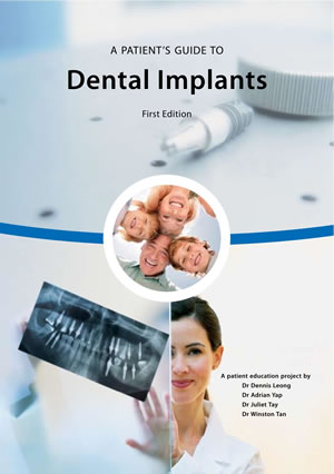 tn-A-Patients-Guide-to-Dental-Implants